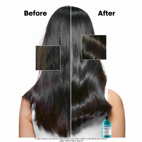 안티 댄드러프 샴푸 - 로레알 프로페셔널 | L'Oréal 파트너샵